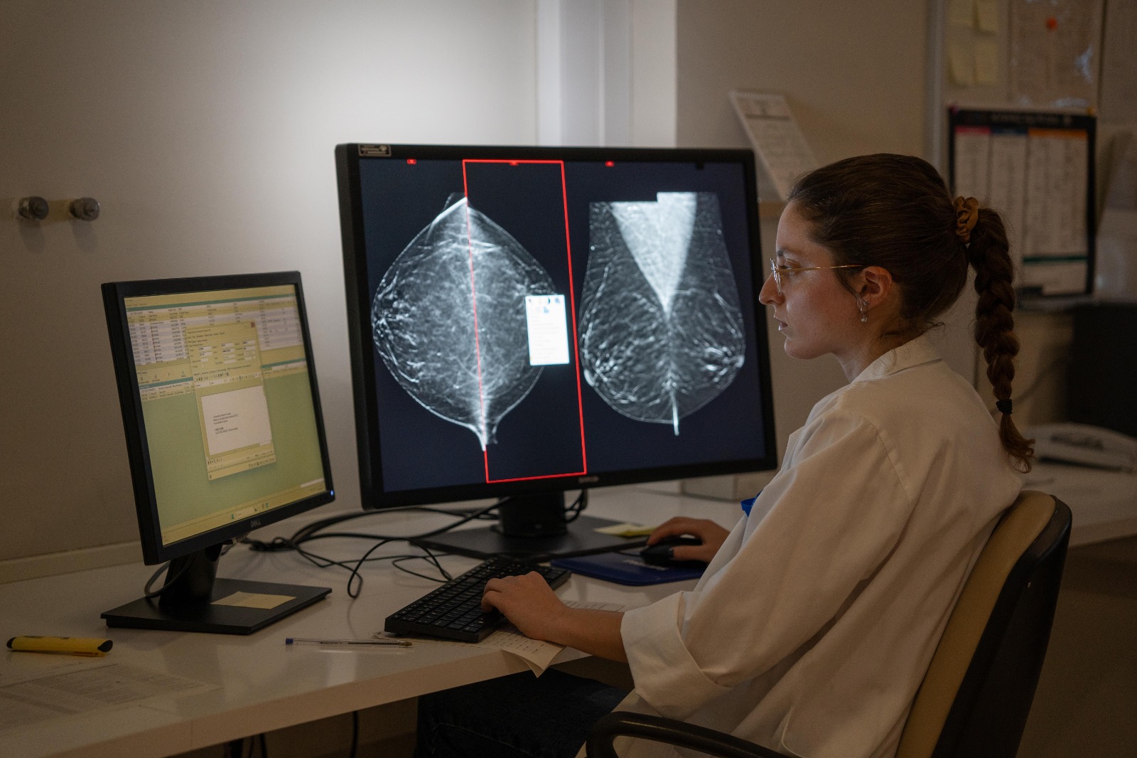 Imagen de la noticia: El Reina Sofía y el IMIBIC estudian con IA el riesgo de cáncer de mama